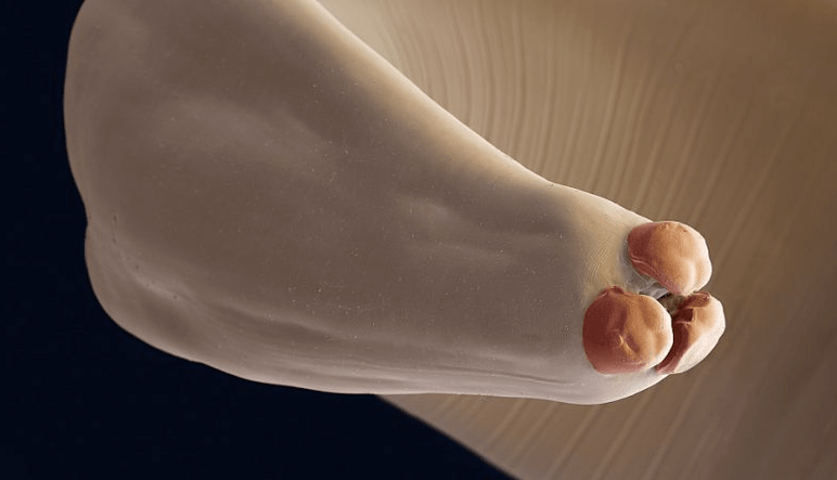 Helminths