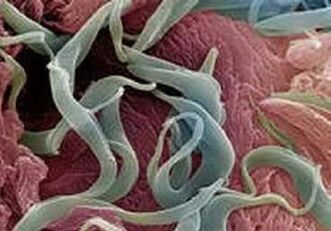 Simptomi in zdravljenje parazitov v človeškem telesu