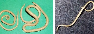 katere parazite lahko ima človek