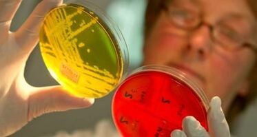 diagnoza parazitov v telesu